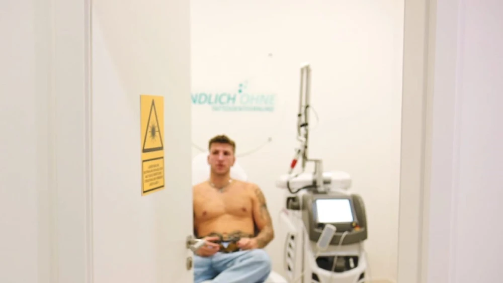 Laser Behandlung cover-up