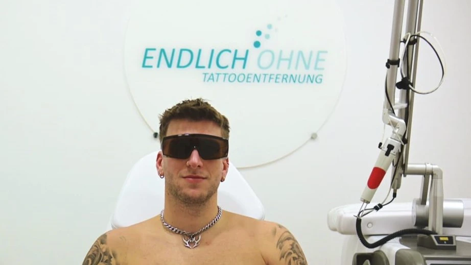 Laser Behandlung cover-up endlich-ohne