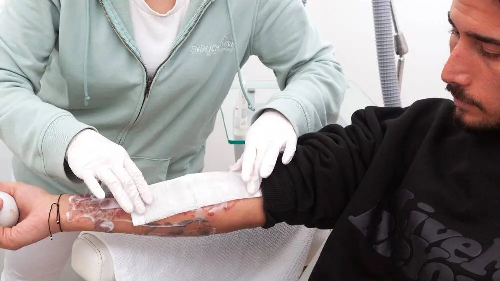 nachsorge tattooentfernung
