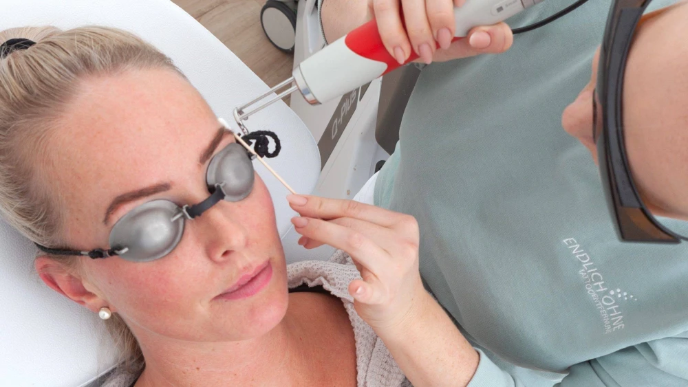 Permanent Make-Up Entfernung
