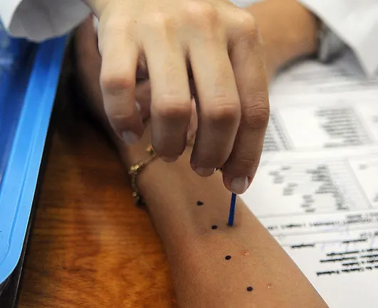 Tattoo Allergie